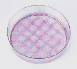 Cells showing preferential growth in warmer areas.